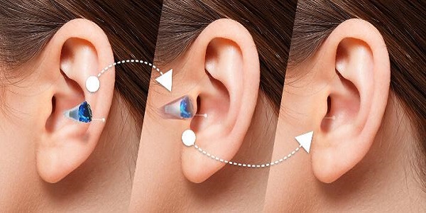 An Image Denoting The Additional Parts of Hearing Aids.